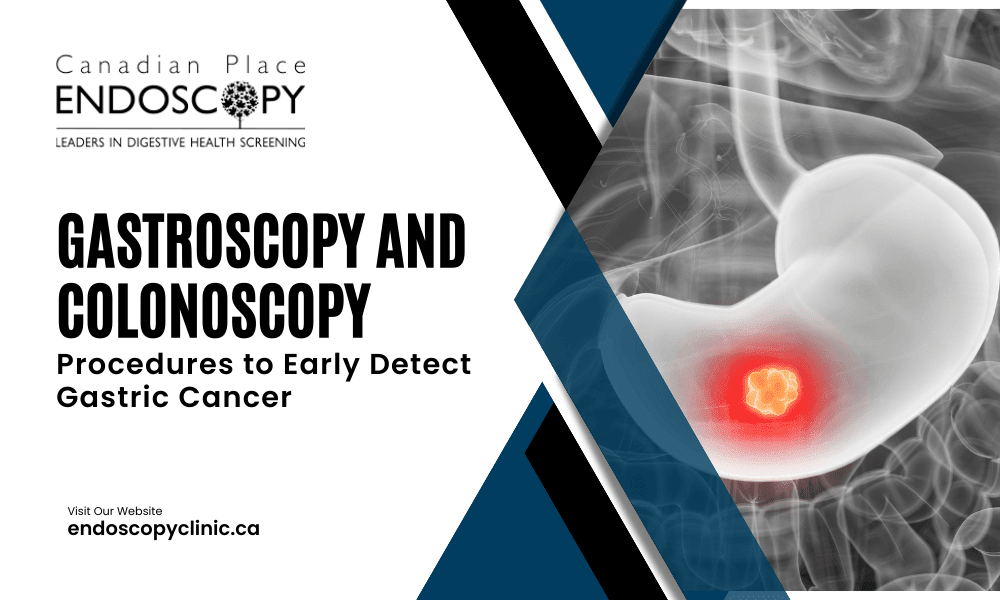 Gastroscopy and colonoscopy: key procedures to early detect